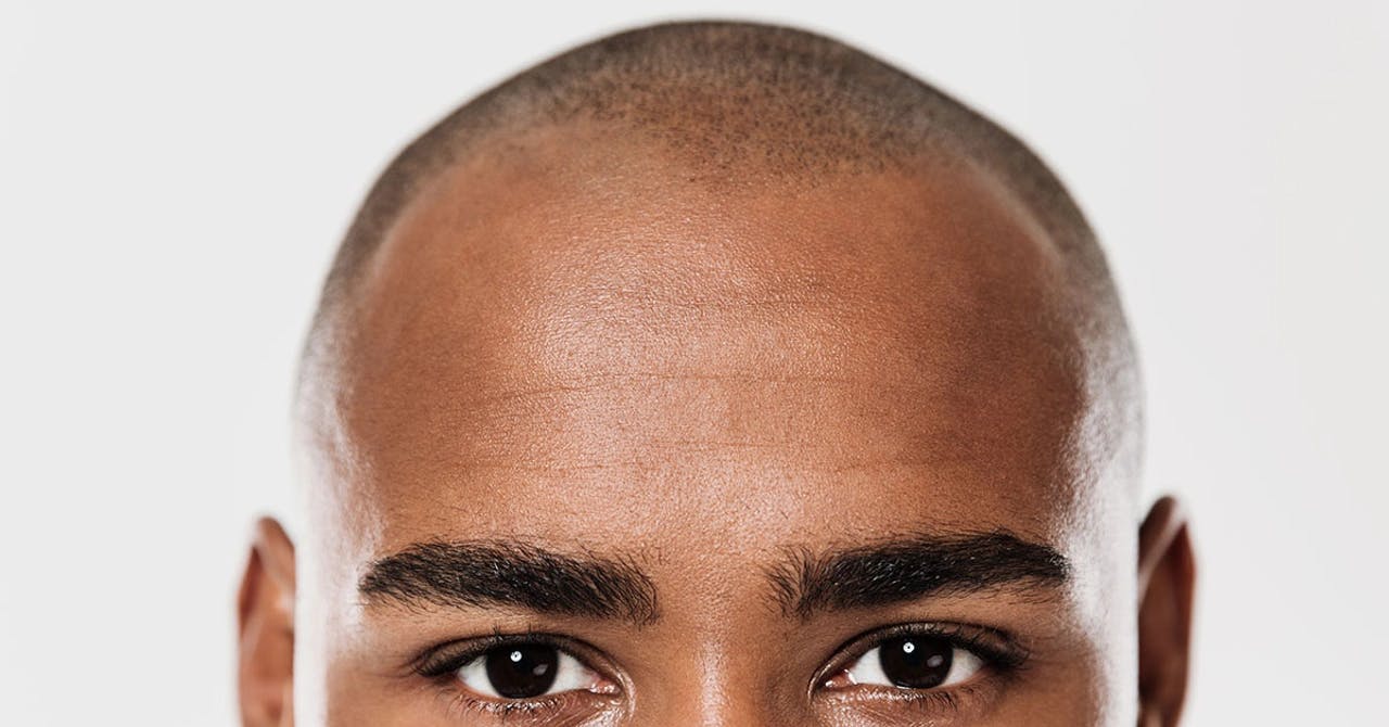 Haircuts to hide baldness - DHI Panamá